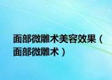 面部微雕术美容效果（面部微雕术）