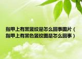 指甲上有黑竖纹是怎么回事图片（指甲上有黑色竖纹图是怎么回事）