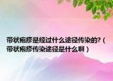 带状疱疹是经过什么途径传染的?（带状疱疹传染途径是什么啊）