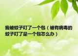 我被蚊子叮了一个包（被有病毒的蚊子叮了是一个包怎么办）