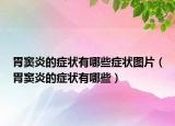 胃窦炎的症状有哪些症状图片（胃窦炎的症状有哪些）