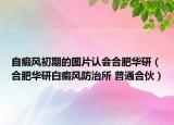 自癜风初期的图片认会合肥华研（合肥华研白癜风防治所 普通合伙）