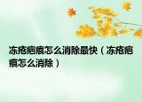 冻疮疤痕怎么消除最快（冻疮疤痕怎么消除）