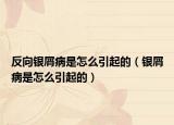 反向银屑病是怎么引起的（银屑病是怎么引起的）
