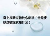 身上皮肤过敏什么症状（全身皮肤过敏症状是什么）