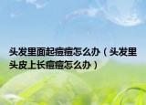 头发里面起痘痘怎么办（头发里头皮上长痘痘怎么办）