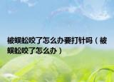被蜈蚣咬了怎么办要打针吗（被蜈蚣咬了怎么办）