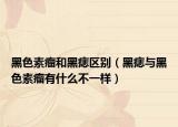 黑色素瘤和黑痣区别（黑痣与黑色素瘤有什么不一样）