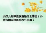 小孩儿指甲盖脱落是什么原因（小孩指甲盖脱落是怎么回事）