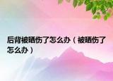 后背被晒伤了怎么办（被晒伤了怎么办）