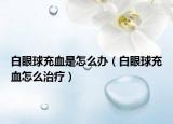 白眼球充血是怎么办（白眼球充血怎么治疗）