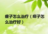 瘥子怎么治疗（痱子怎么治疗好）