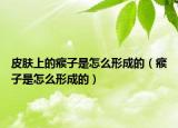 皮肤上的瘊子是怎么形成的（瘊子是怎么形成的）
