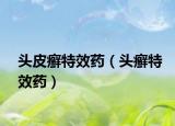 头皮癣特效药（头癣特效药）