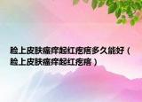 脸上皮肤瘙痒起红疙瘩多久能好（脸上皮肤瘙痒起红疙瘩）