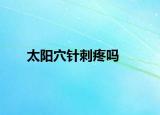 太阳穴针刺疼吗