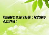 蛇皮癣怎么治疗好的（蛇皮癣怎么治疗好）