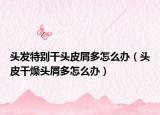 头发特别干头皮屑多怎么办（头皮干燥头屑多怎么办）