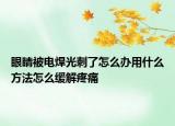 眼睛被电焊光刺了怎么办用什么方法怎么缓解疼痛