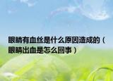 眼睛有血丝是什么原因造成的（眼睛出血是怎么回事）