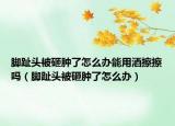 脚趾头被砸肿了怎么办能用酒擦擦吗（脚趾头被砸肿了怎么办）