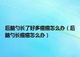 后脑勺长了好多痘痘怎么办（后脑勺长痘痘怎么办）