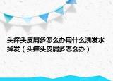 头痒头皮屑多怎么办用什么洗发水掉发（头痒头皮屑多怎么办）