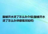 脚被开水烫了怎么办介绍(脚被开水烫了怎么办详细情况如何)