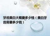 牙齿美白大概要多少钱（美白牙齿需要多少钱）