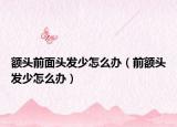 额头前面头发少怎么办（前额头发少怎么办）