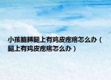 小孩胳膊腿上有鸡皮疙瘩怎么办（腿上有鸡皮疙瘩怎么办）