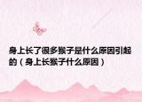身上长了很多猴子是什么原因引起的（身上长猴子什么原因）