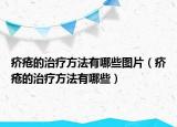 疥疮的治疗方法有哪些图片（疥疮的治疗方法有哪些）