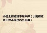 小腿上有红斑不痛不痒（小腿有红斑不痒不痛是怎么回事）