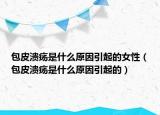 包皮溃疡是什么原因引起的女性（包皮溃疡是什么原因引起的）