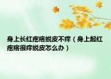 身上长红疙瘩蜕皮不痒（身上起红疙瘩很痒蜕皮怎么办）