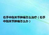 右手中指关节肿痛怎么治疗（右手中指关节肿痛怎么办）