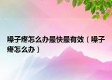 嗓子疼怎么办最快最有效（嗓子疼怎么办）