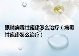 眼睛病毒性疱疹怎么治疗（病毒性疱疹怎么治疗）