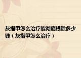 灰指甲怎么治疗能彻底根除多少钱（灰指甲怎么治疗）
