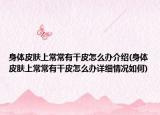 身体皮肤上常常有干皮怎么办介绍(身体皮肤上常常有干皮怎么办详细情况如何)