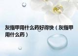 灰指甲用什么药好得快（灰指甲用什么药）
