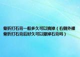 骨折打石膏一般多久可以摘掉（右侧外裸骨折打石膏后好久可以撤掉石膏吗）
