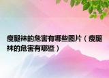 瘦腿袜的危害有哪些图片（瘦腿袜的危害有哪些）