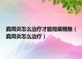 肩周炎怎么治疗才能彻底根除（肩周炎怎么治疗）