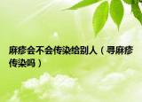 麻疹会不会传染给别人（寻麻疹传染吗）