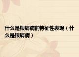 什么是银屑病的特征性表现（什么是银屑病）