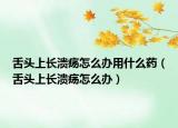 舌头上长溃疡怎么办用什么药（舌头上长溃疡怎么办）
