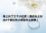 身上长了三个小红痣（最近头上长出4个紫红色小痣是怎么回事）