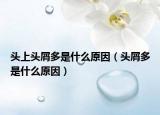 头上头屑多是什么原因（头屑多是什么原因）
